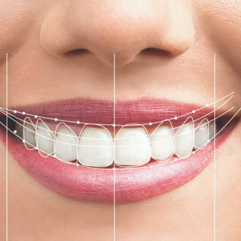 Smile_Design