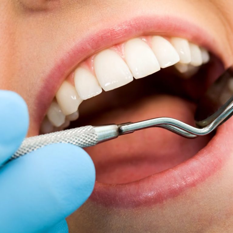 odontologia-preventiva