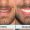 ortodoncia-barcelona-tipos-de-blanqueamiento-dental-2 (1)